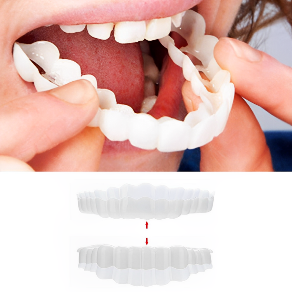 Facings Gebitsprothese Clip On Cosmetisch Tandbedekking