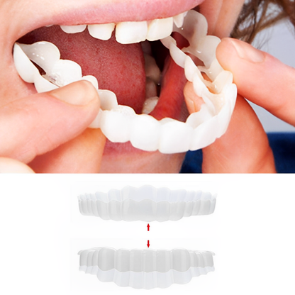 Facings Gebitsprothese Clip On Cosmetisch Tandbedekking