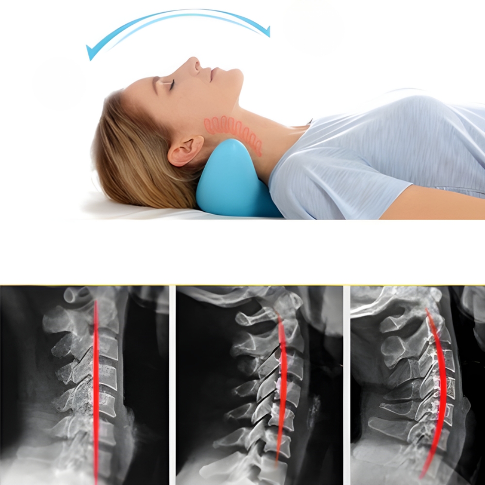 Nekkussen Ergonomisch Nekmassage Stretch Pijnverlichting