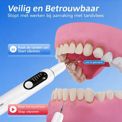 Tandsteen Verwijderaar Elektrisch LED Tanden Reiniger