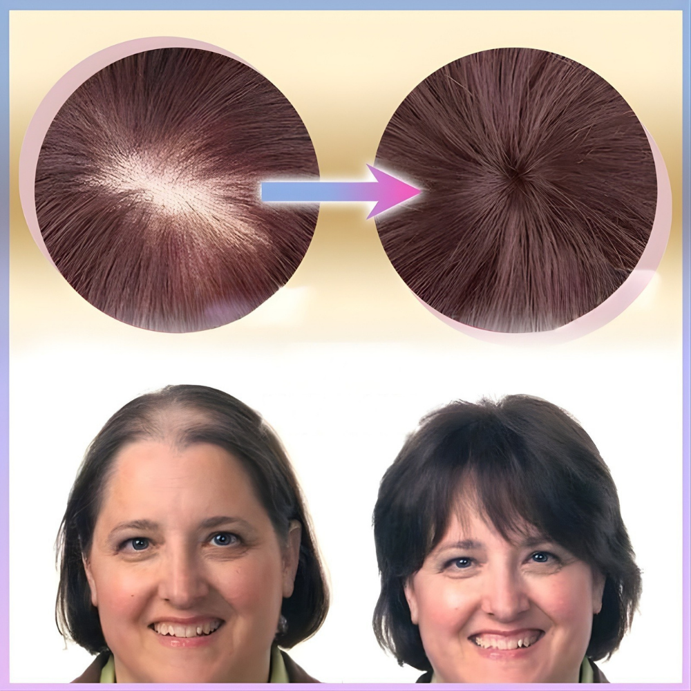 Haarstukje Haar Topper Clip Natuurlijk Volume Haarstuk