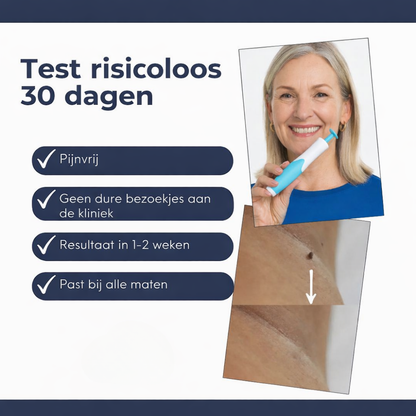 Wrattenverwijderaar Huidtag Verwijderaar Thuis Kit